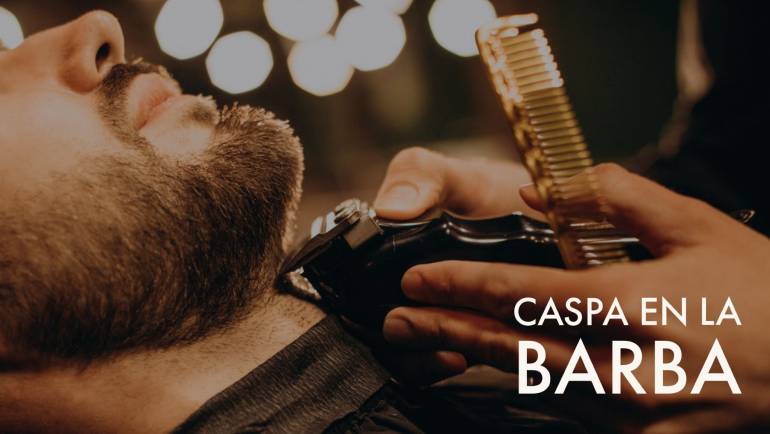 Caspa en la barba